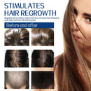 Scrub per capelli Eelhoe Root Restore, idrata, nutre, ripara, radici, estratto di piante biologiche, scrub per il cuoio capelluto, anti-caduta, detergente profondo, olio e sporco, scrub per la cura dei capelli danneggiati