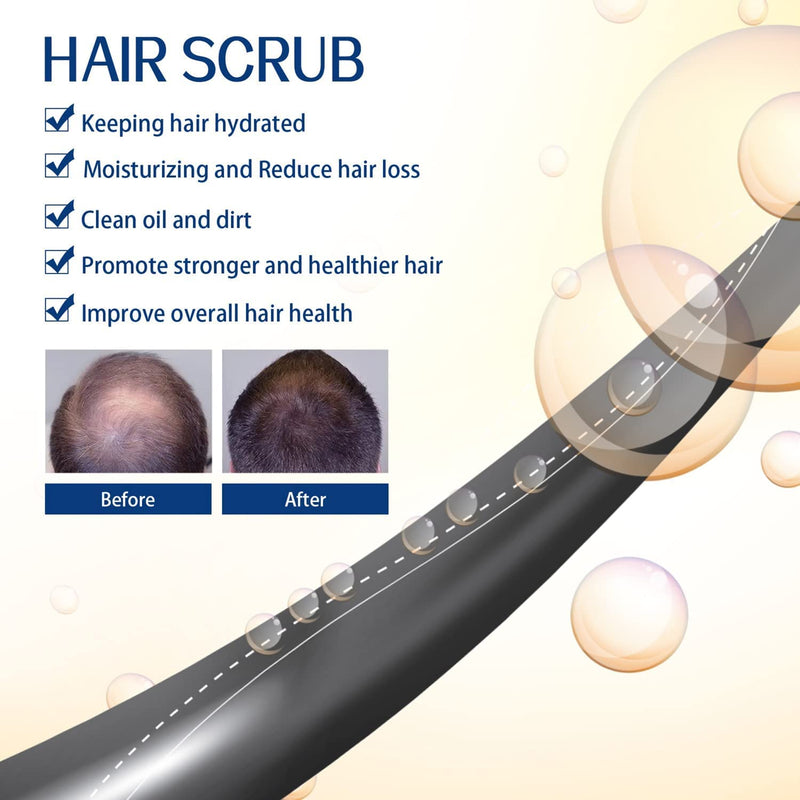 Eelhoe Root Restore Hair Scrub Moisturizes Nourishing Repair Roots Organic Plant Extract Scalp Scrub Anti-Hair Loss Deep Cleansing Oil And Dirt Damaged Hair Care Scrub