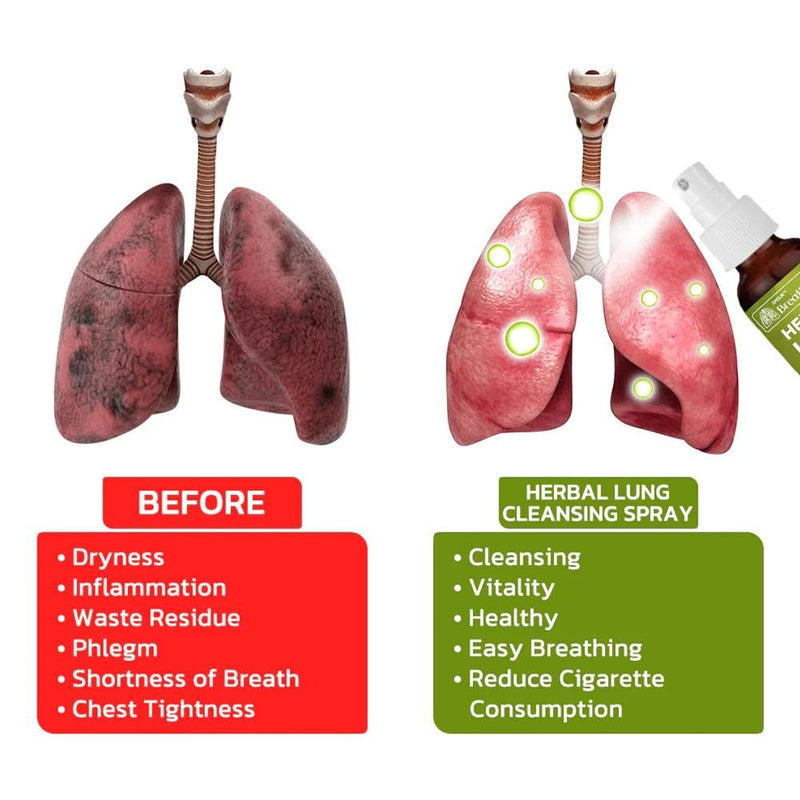 BreathDetox Herbal Lung Cleansing Spray, Herbal Lung Cleanse Spray, Natural Respiratory Cleanse & Breathe Spray, Lung Exerciser for Healthier and Cleaner Lungs