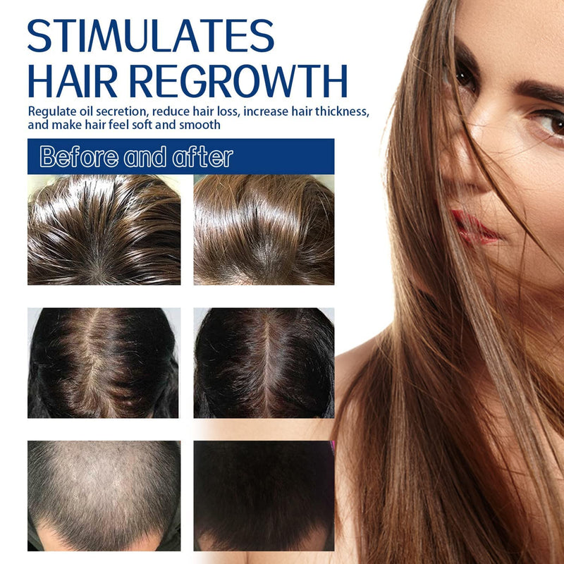 Eelhoe Root Restore Hair Scrub Moisturizes Nourishing Repair Roots Organic Plant Extract Scalp Scrub Anti-Hair Loss Deep Cleansing Oil And Dirt Damaged Hair Care Scrub