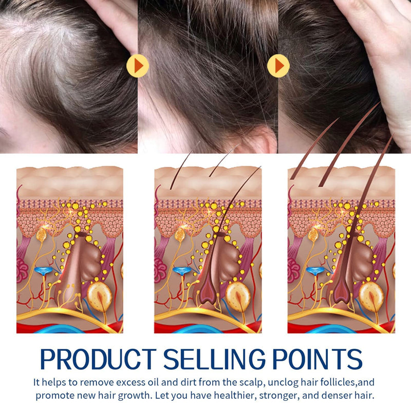 Eelhoe Root Restore Hair Scrub Moisturizes Nourishing Repair Roots Organic Plant Extract Scalp Scrub Anti-Hair Loss Deep Cleansing Oil And Dirt Damaged Hair Care Scrub