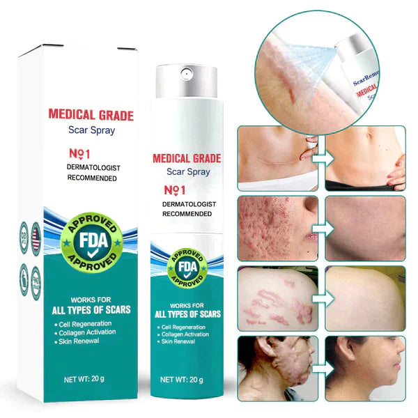LOVILDS™ Advanced Scar Spray for all types of scars