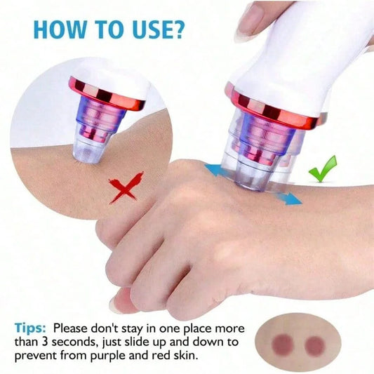 Aspirapori Viso: Strumento Professionale per Punti Neri e Imperfezioni