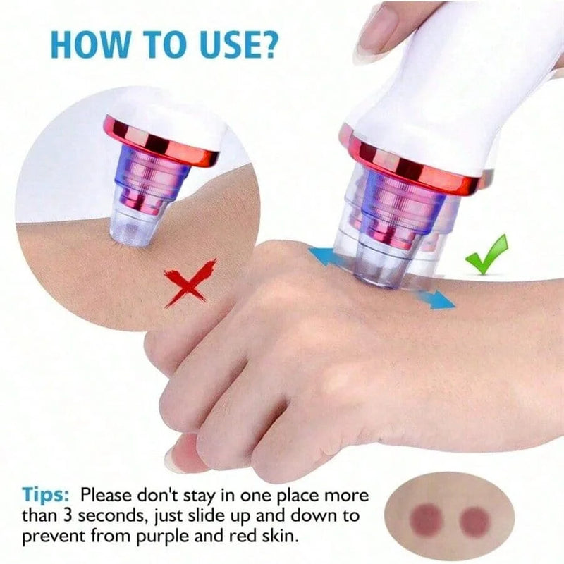 Aspirapori Viso: Strumento Professionale per Punti Neri e Imperfezioni