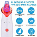 Aspirapori Viso: Strumento Professionale per Punti Neri e Imperfezioni