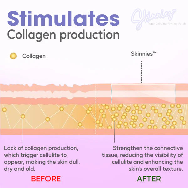 Skinnies™ Anti-Cellulite Firming Adhesive
