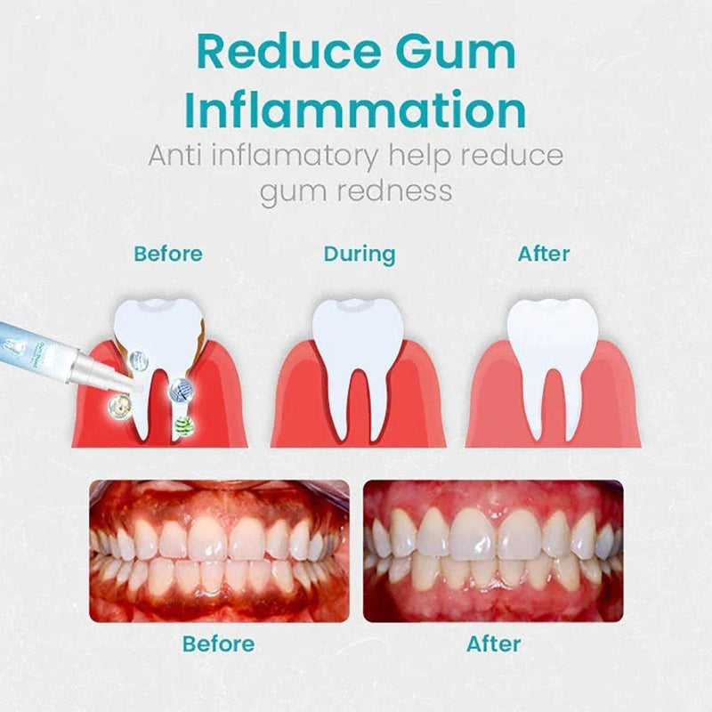 Gum Treatment Gel, Reduces Discomfort Oral Care Gum Shield Therapy Gel, Easy to Use Reduces Inflammation  Repair  Protect Repair Gels