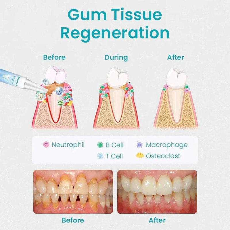 Gum Treatment Gel, Reduces Discomfort Oral Care Gum Shield Therapy Gel, Easy to Use Reduces Inflammation  Repair  Protect Repair Gels