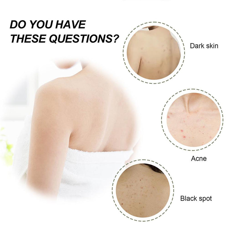 South Moon KeratosisTreat Deep Clean Smooth Cream