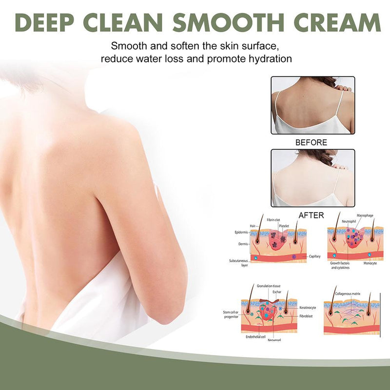 South Moon KeratosisTreat Deep Clean Smooth Cream