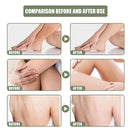 Crema liscia e detergente profonda per cheratosi della luna meridionale