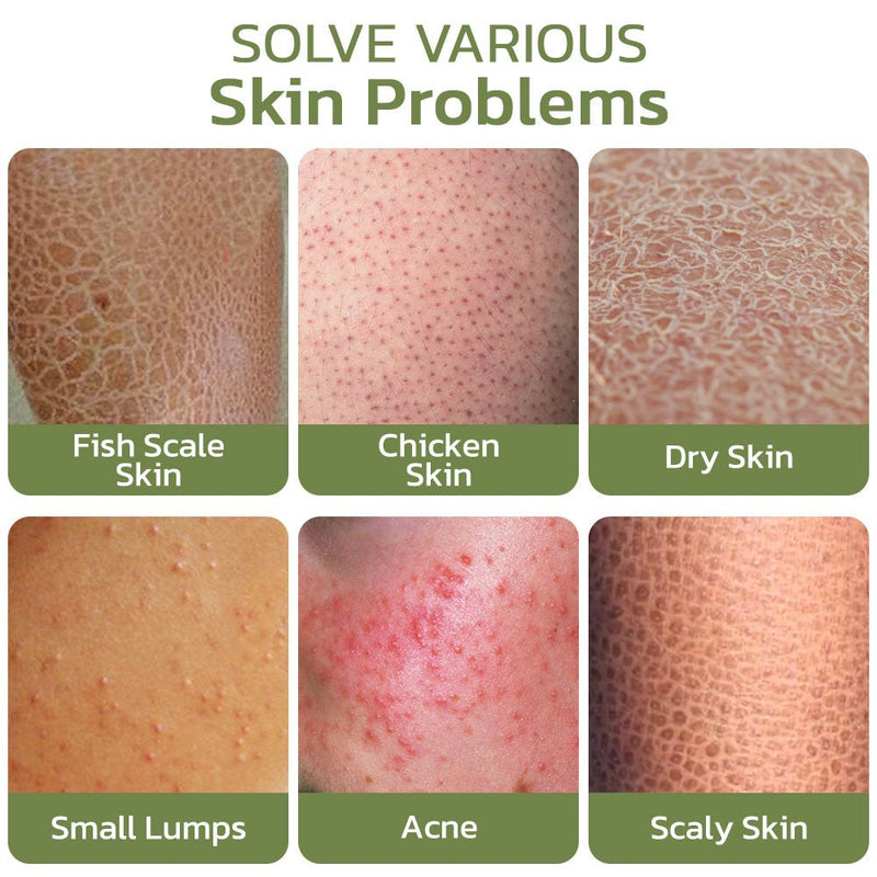 South Moon KeratosisTreat Deep Clean Smooth Cream